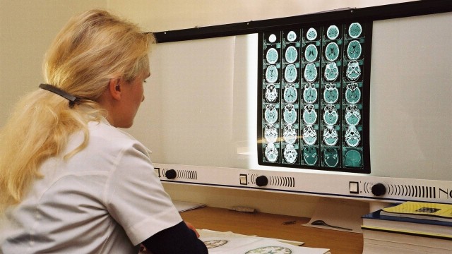 Biópsia líquida indica recorrências do câncer até três meses antes do que a tomografia computadorizada (foto)