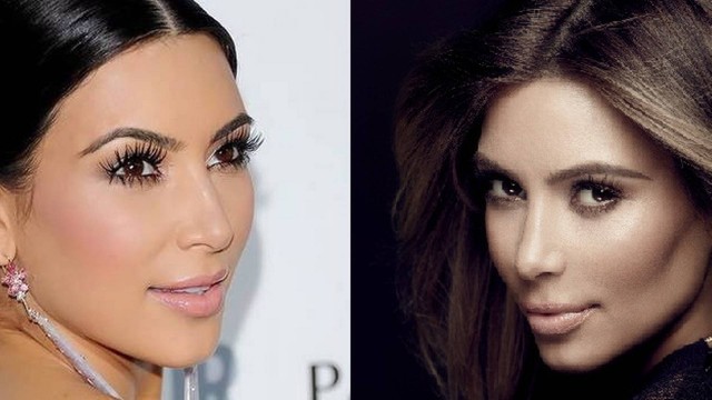 Famosa nas redes, Kim Kardashian testou a lipo de bochechas