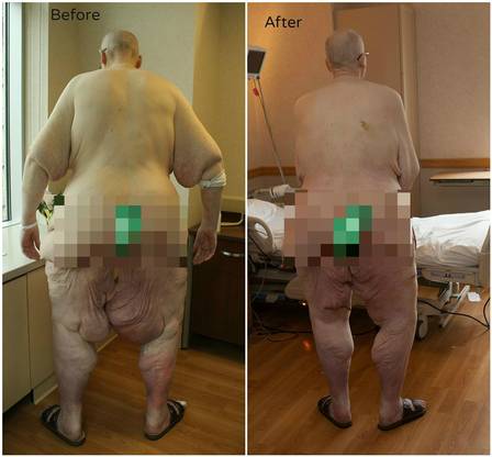 Paul Jonathan Mason divulgou uma foto do antes e o depois: as pernas estavam inflamadas