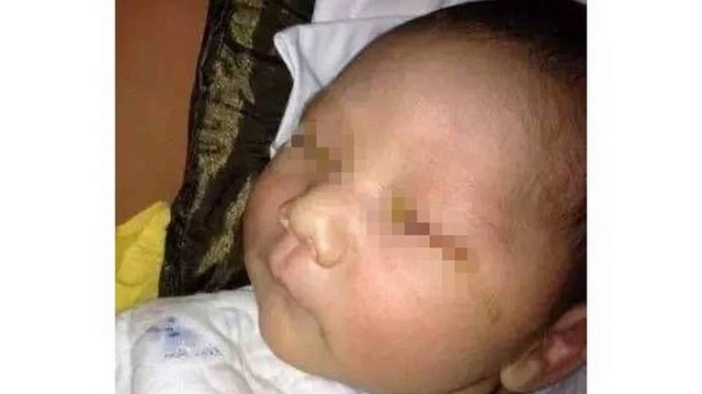 Bebê teria perdido a visão após ter sido fotografado de perto com flash.