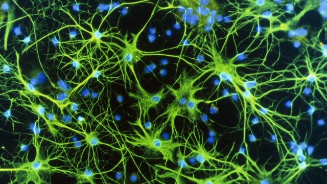 Redes de neurônios no cérebro: memórias traumáticas são registradas em processo mediado por moléculas diferentes das que codificam lembranças normais, o que faz com que só possam ser acessadas sob condições mentais similares