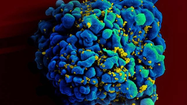 Análise genética do câncer de pênis pode prever risco de metástase