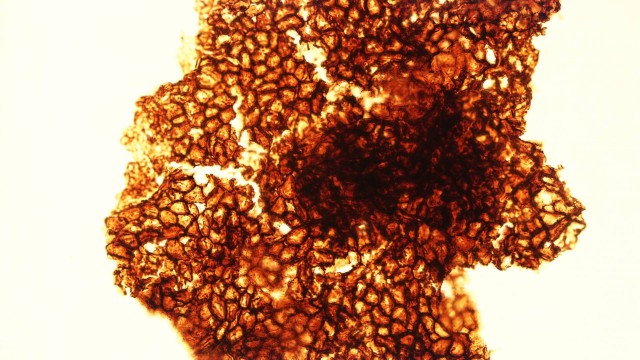 Imagem de microscópio de um dos fósseis revela a aparente organização de suas células, o que sugere que era de fato um organismo multicelular