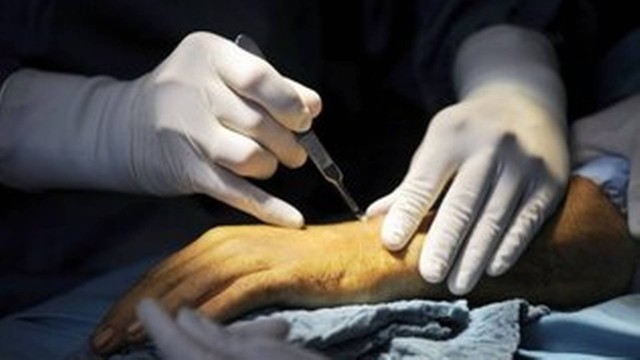 Cirurgião de mão é profissão em alta