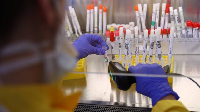 Testes rápidos foram desenvolvidos em várias partes do mundo para diagnosticar a infecção pelo coronavírus. Na foto, exame criado pelo Hospital Universitário de Frankfurt e pela Cruz Vermelha da Alemanha.
