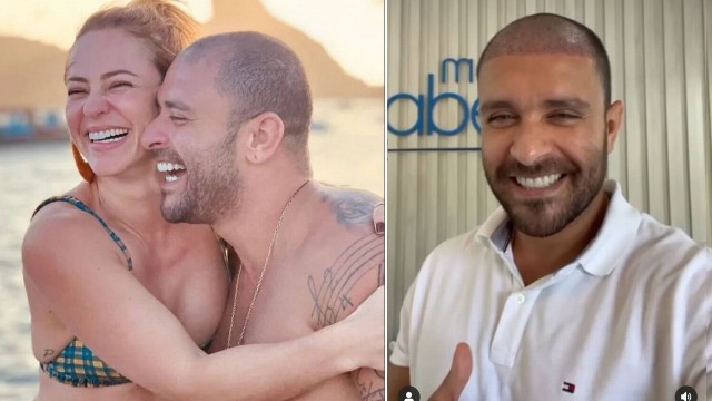 Diogo Nogueira recorre ao transplante capilar aos 40 anos