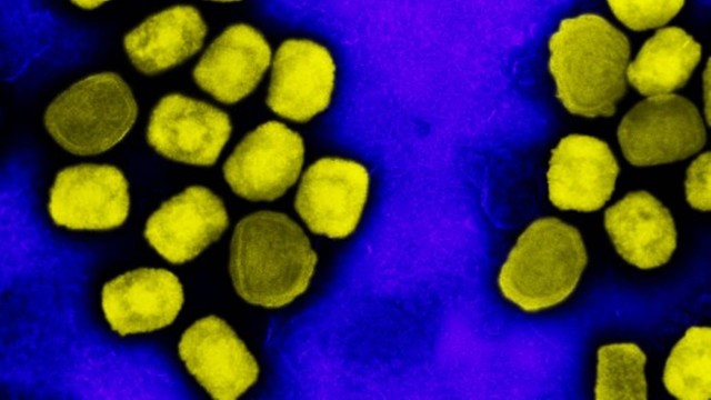 Micrografia eletrônica de transmissão colorida de partículas do vírus da varíola do macaco cultivadas e purificadas a partir de cultura de células