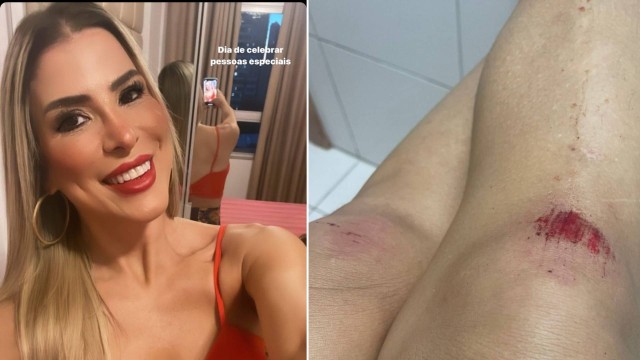 Ex-BBB Milena Fagundes diz que foi agredida com latas e empurrão em festa de Caprichoso no AM