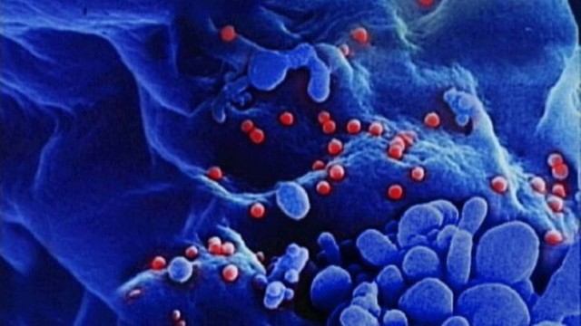 Vírus HIV infecta células do sistema imunológico