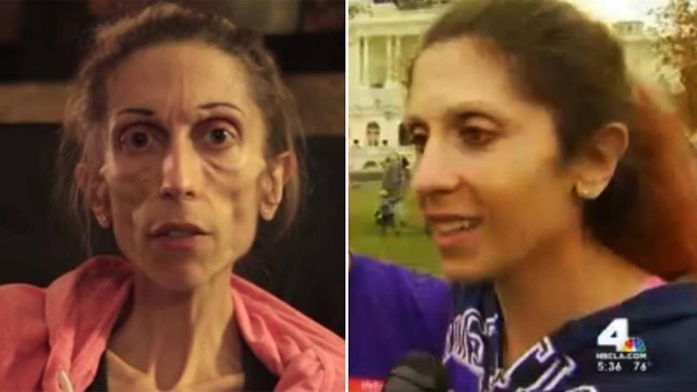 Antes e depois: Rachel Farouk surpreendeu com recuperação.