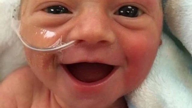 Foto de bebê sorridente ajudou a mãe a enfrentar dias difíceis na UTI Neonatal