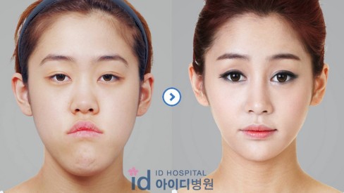 Antes e depois das cirurgias plásticas
