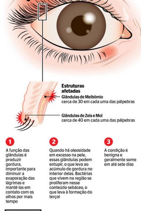 Terçol interno. É perigoso?