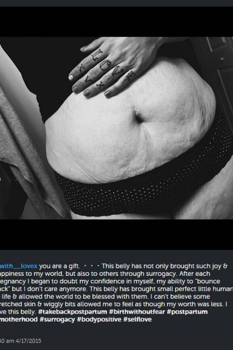 Mãe publica foto da barriga no pós-parto e promove reflexão