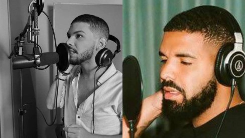 Ex-BBB Vyni ganha elogios após harmonização facial e é comparado com Drake