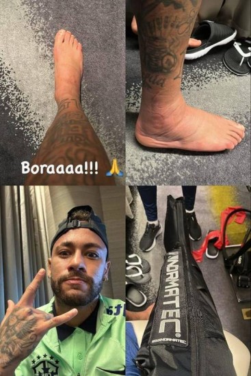 NEYMAR JOGA HOJE PELO BRASIL? Veja se NEYMAR JOGA CONTRA CAMARÕES e  detalhes sobre NEYMAR RECUPERAÇÃO