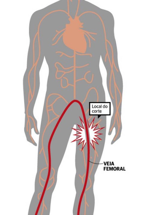 Arteria E Veia Femoral 281 Veia Femoral Stock Photos, High Res