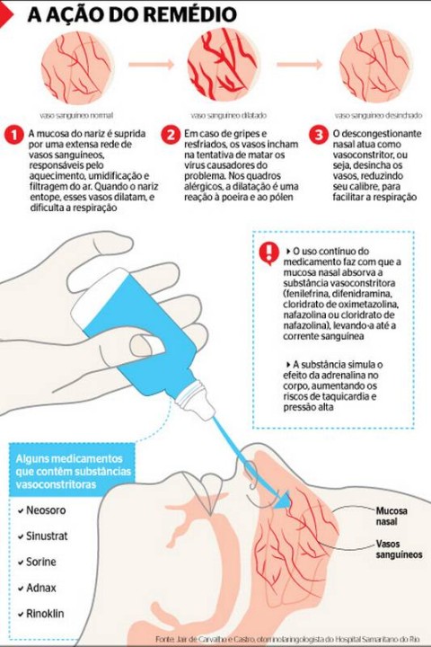 Descongestionante nasal: para qué sirve y tipos - Tua Saúde